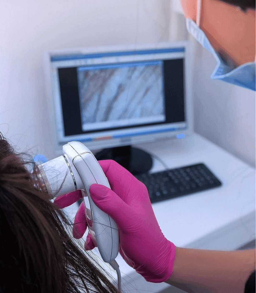 Trichoscopy (Digital Scalp Microscopy)