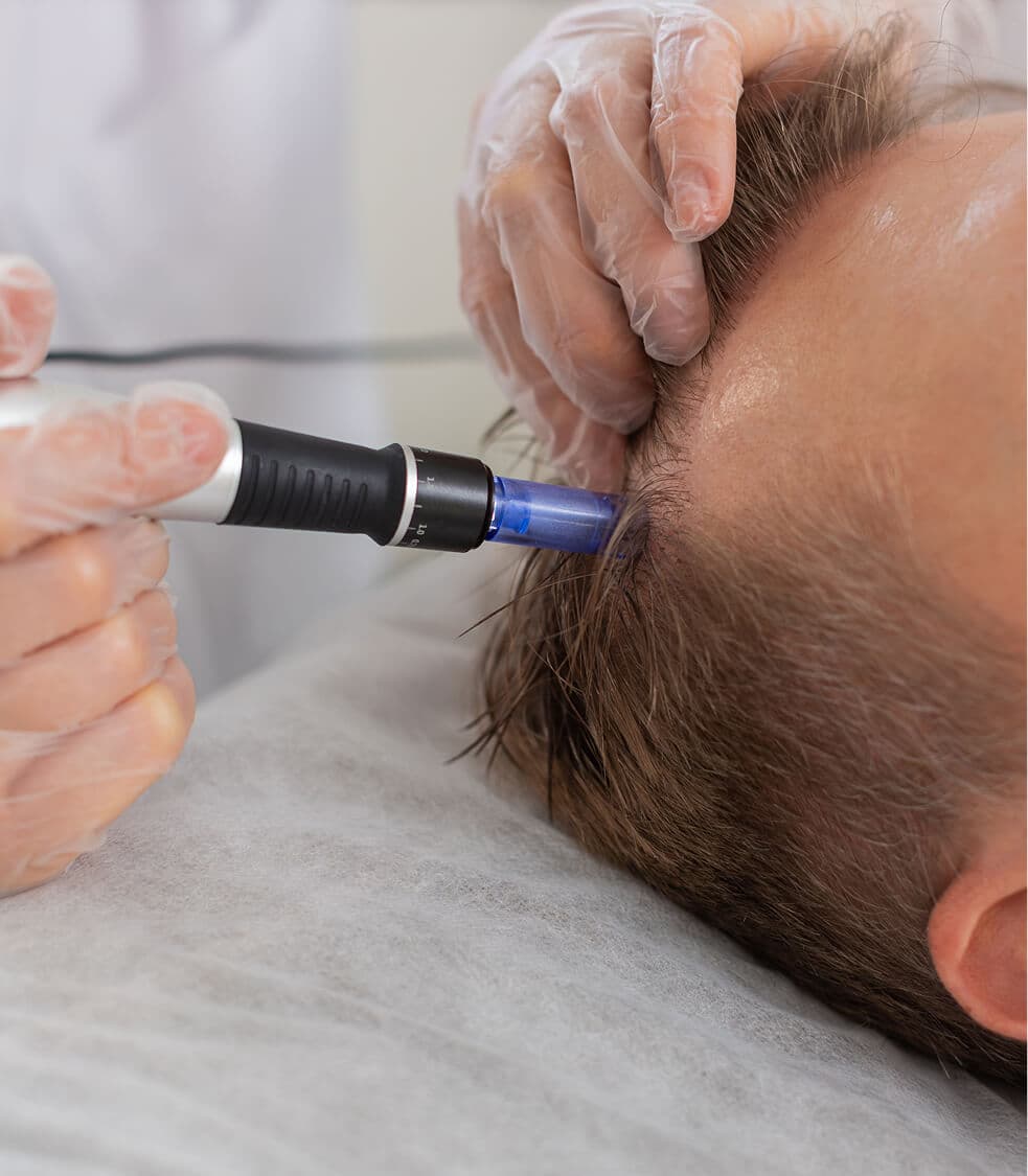 Exocobiome Scalp Rejuvenation