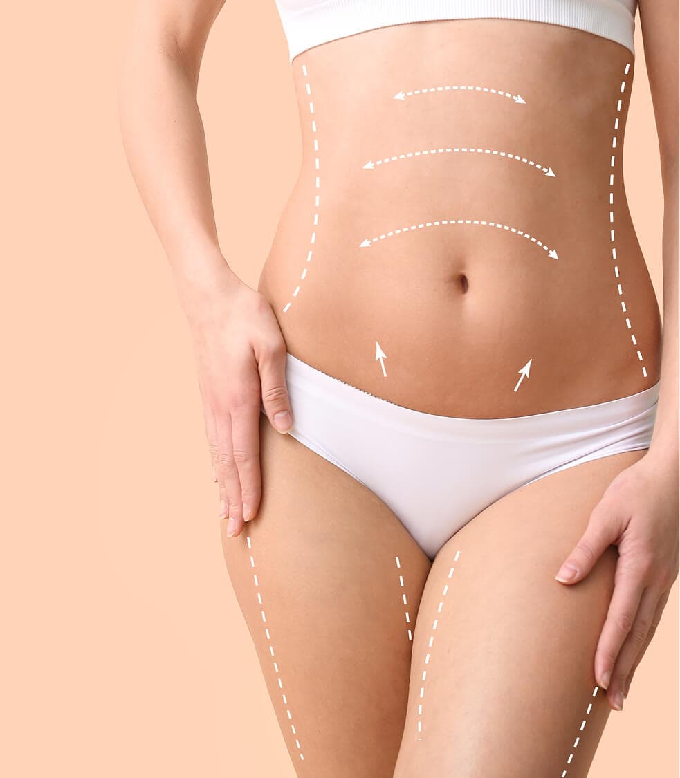 Stubborn Fat & Inch Loss