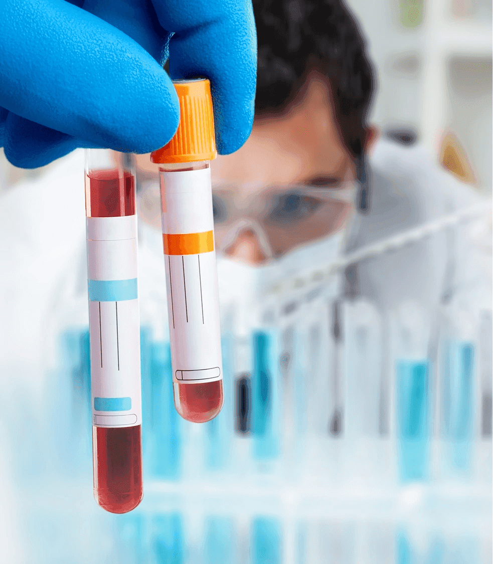 Comprehensive Blood Panels